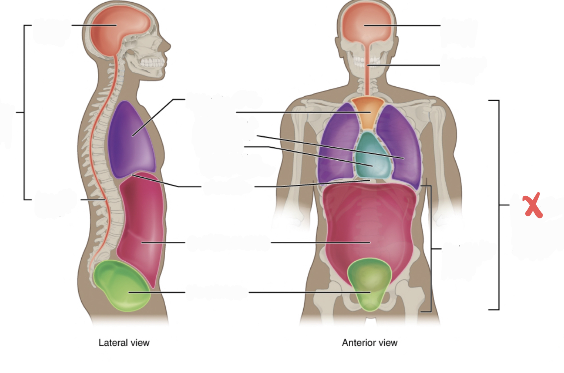 <p>Includes thoracic and abdominopelvic cavities</p>