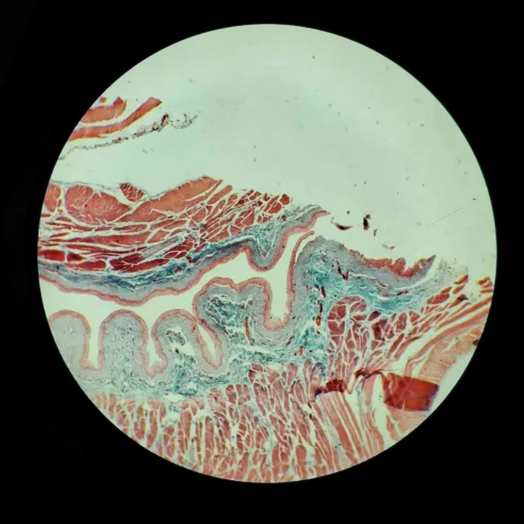 term image