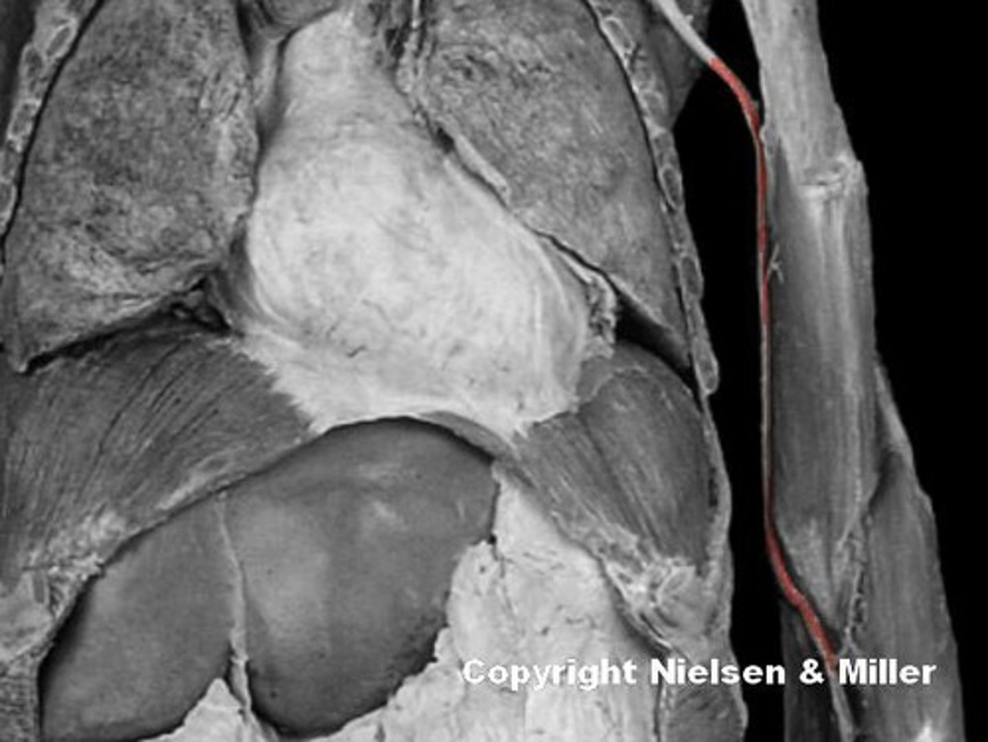 <p>Identify the highlighted vessel.</p>