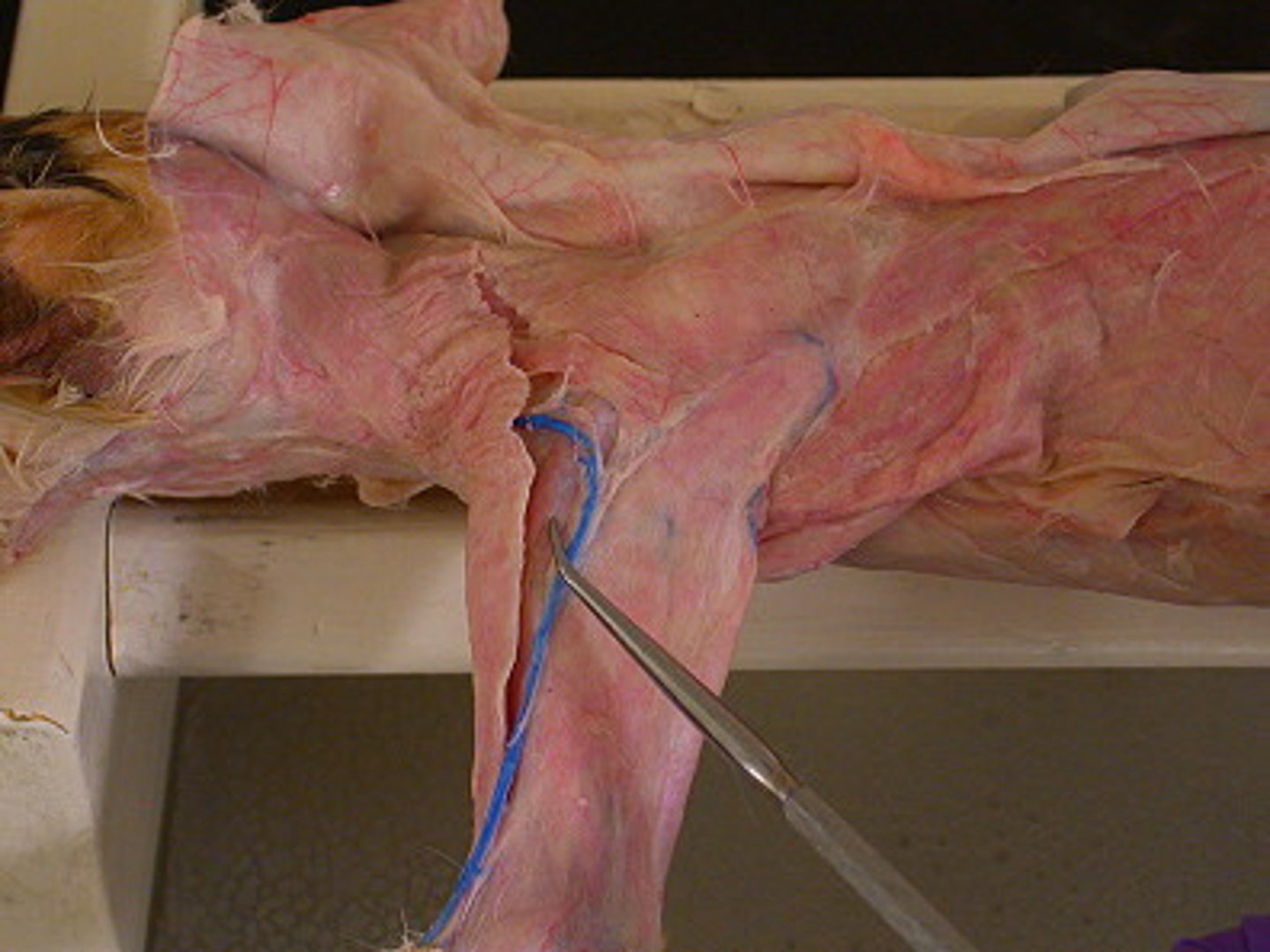 <p>name this muscle</p>
