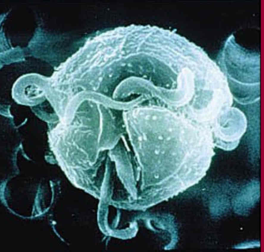 <p>Dinoflagellati responsabile della moria di pesci marini, perché l’inquinamento antropico produce una tossina che provoca lesioni dei tessuti cutanei dei pesci, di cui si nutrono i parassiti</p>