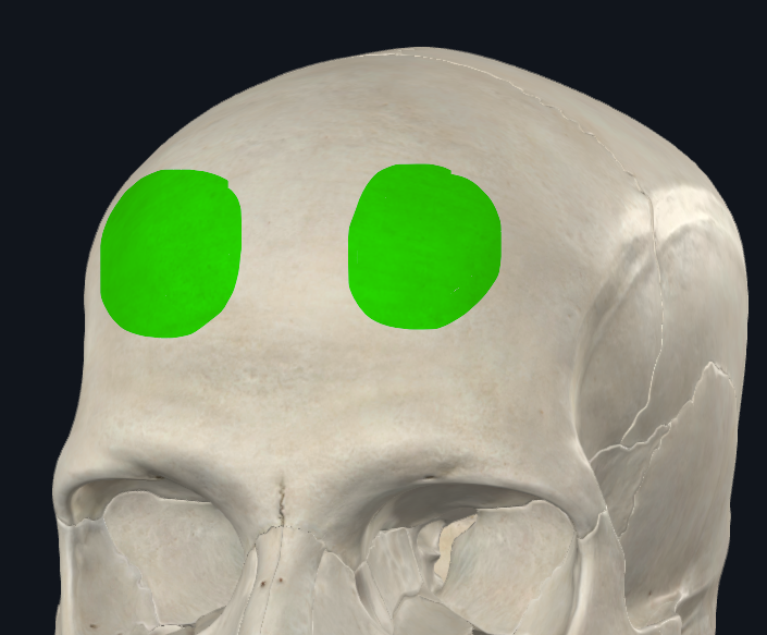 <p>o Tuberosidades</p>