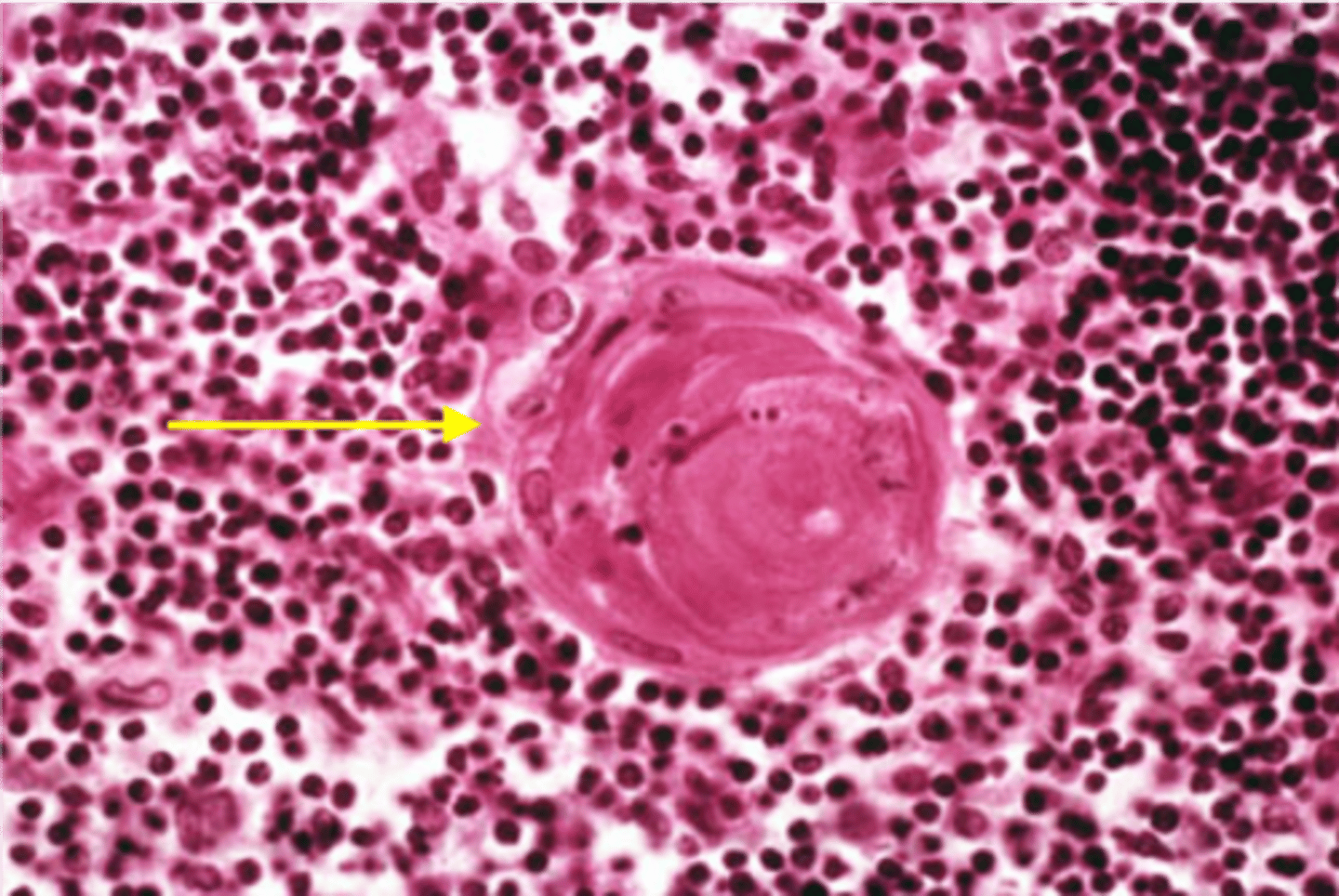 <p>distinguishing feature of the thymus gland</p>