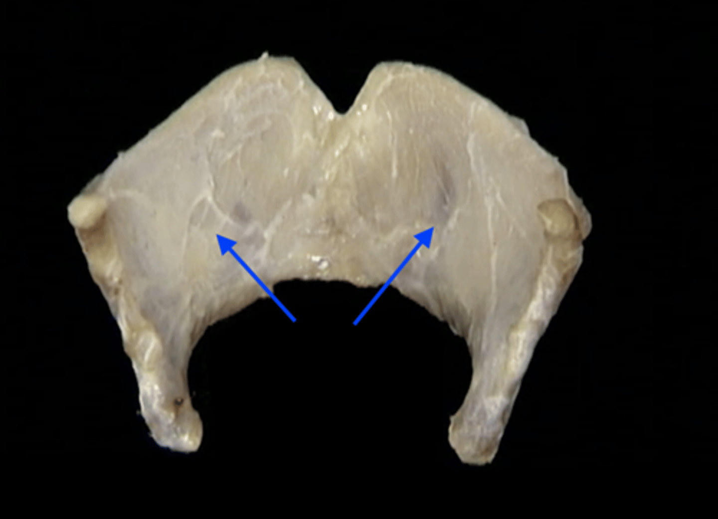 <p><em>identify the structure:</em></p>