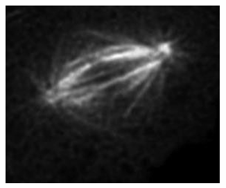 <ul><li><p>Looks at the dynamics of living cells instead of just fixed </p></li><li><p>Green Fluorescent Protein (GFP) is a natural fluorescent protein from jellyfish.</p></li><li><p>Recombinant DNA technology fuses the gene for GFP with a protein’s gene, creating a protein-GFP fusion.</p></li><li><p>Once expressed in cells, the fusion protein is now fluorescent</p><ul><li><p>reveals the location and behavior of the protein </p></li></ul></li><li><p>Ex. Tubulin protein fused to GFP within a cell</p><ul><li><p>It shows its location and how microtubules are organizes into a mitotic spinde&nbsp;</p></li></ul></li></ul><p></p>