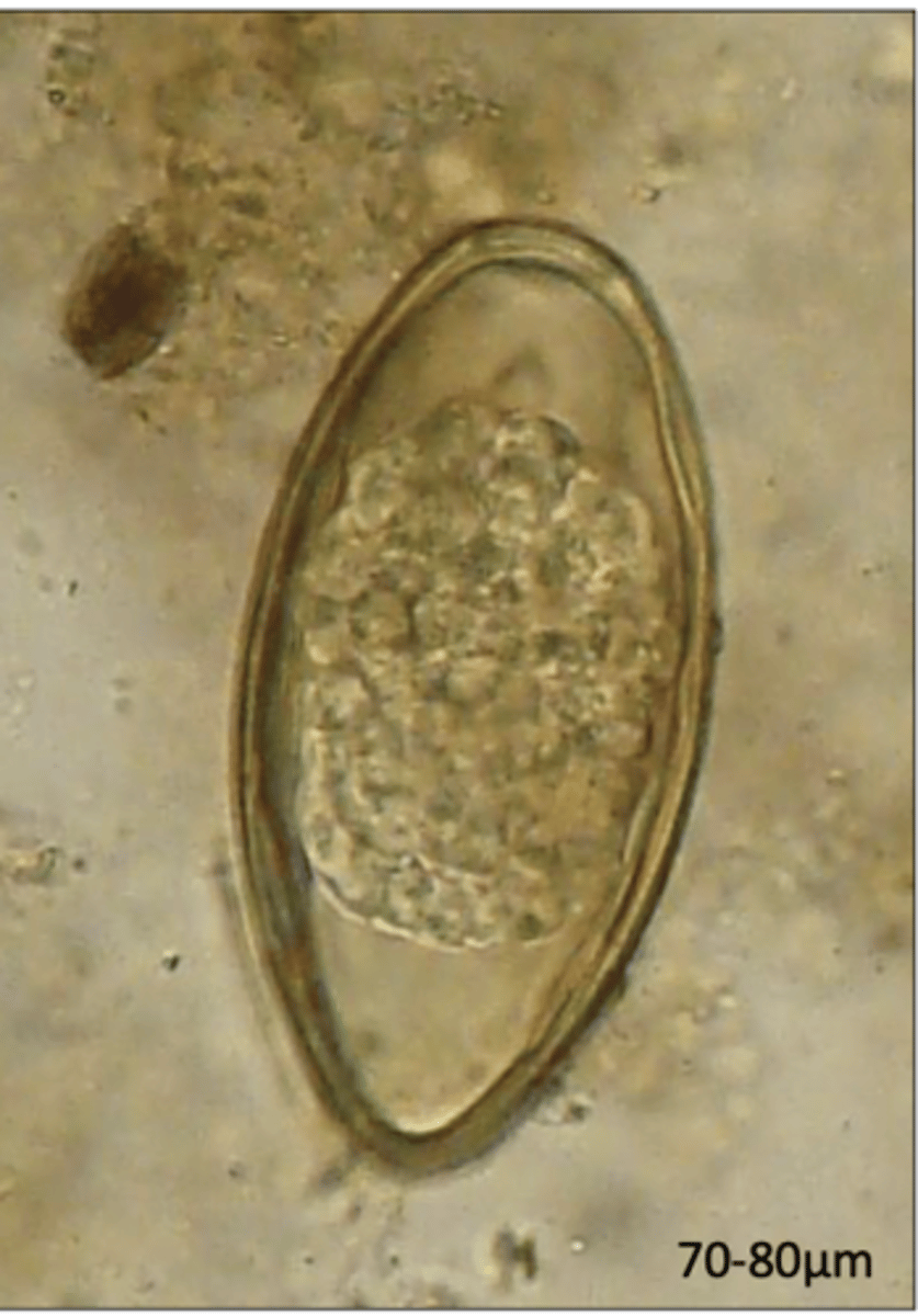 <p>What egg does this parasite belong to? From tape impression of perianal hairs</p>