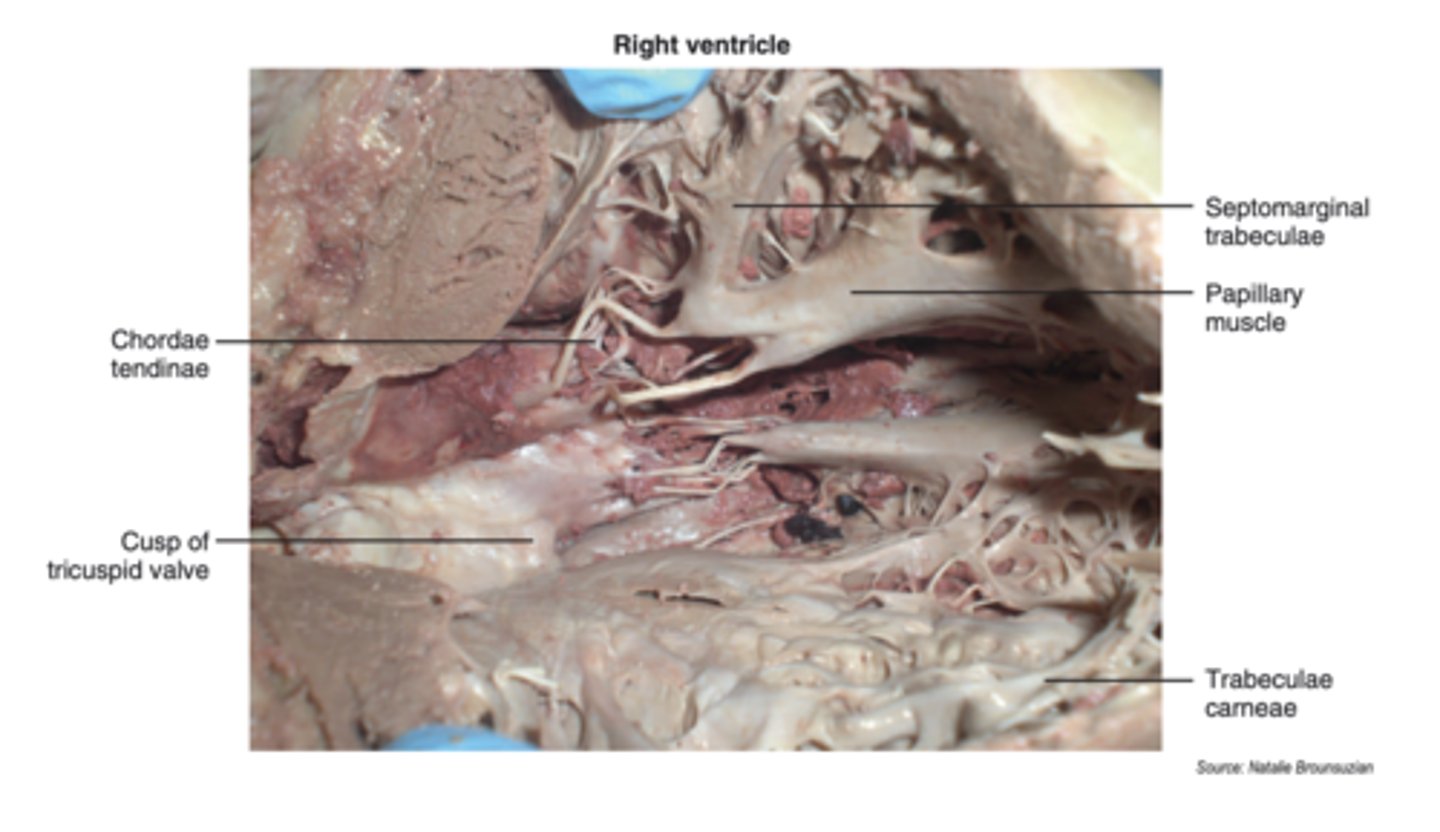 <p>attaches to the interventricular septum and to the anterior papillary muscle</p>