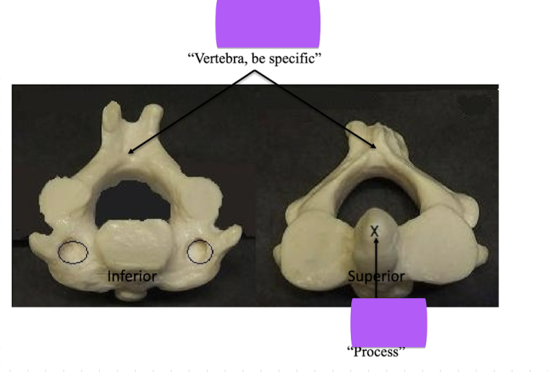 <p>Vertebra, <strong><em>be specific </em></strong></p>