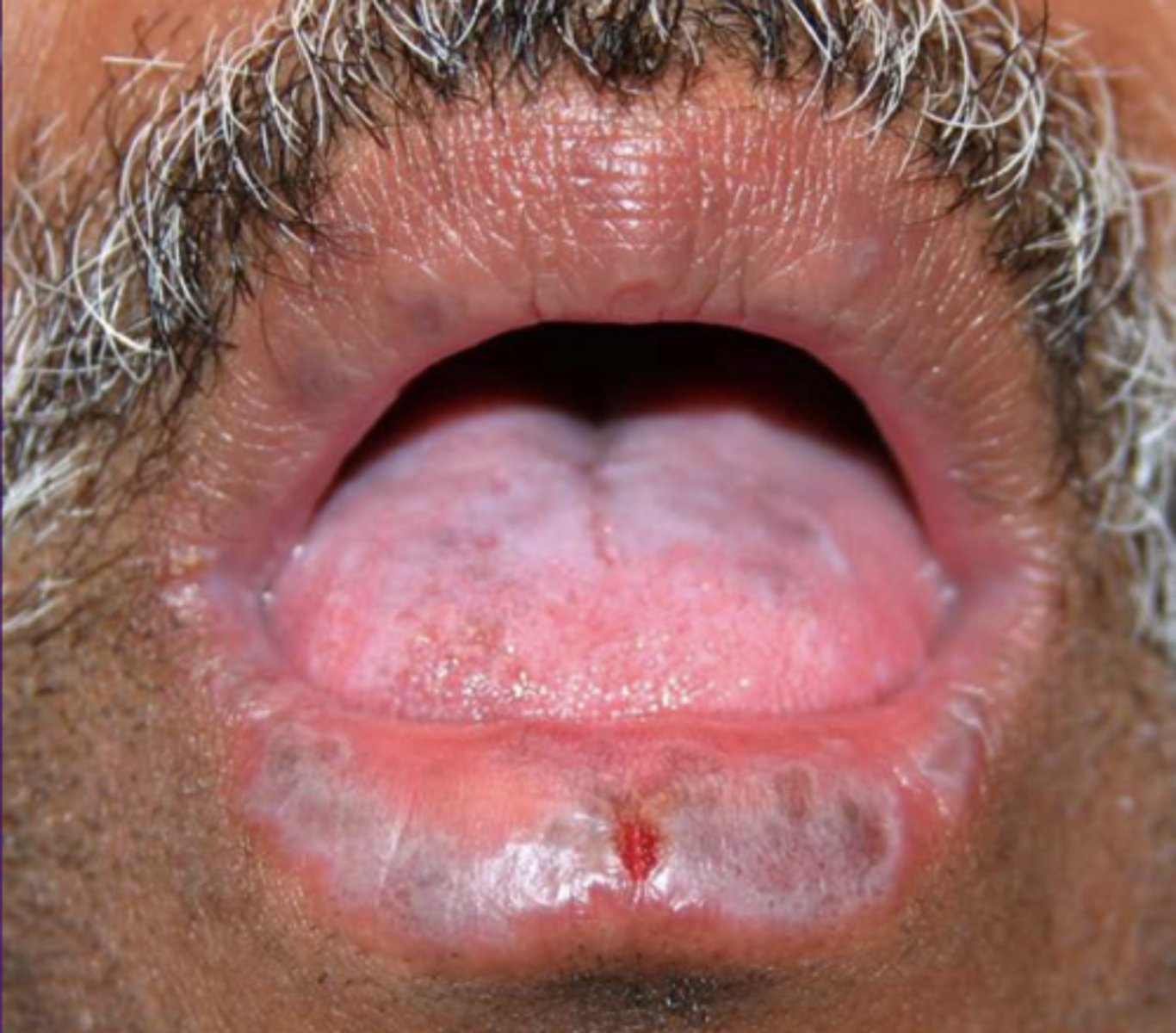 <p>What condition?</p>