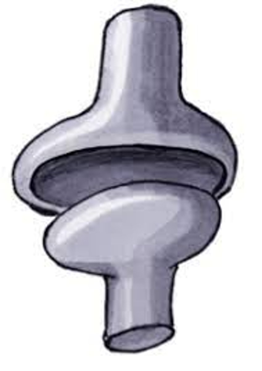 <p>a shallow ball-and-socket joint with limited mobility</p>