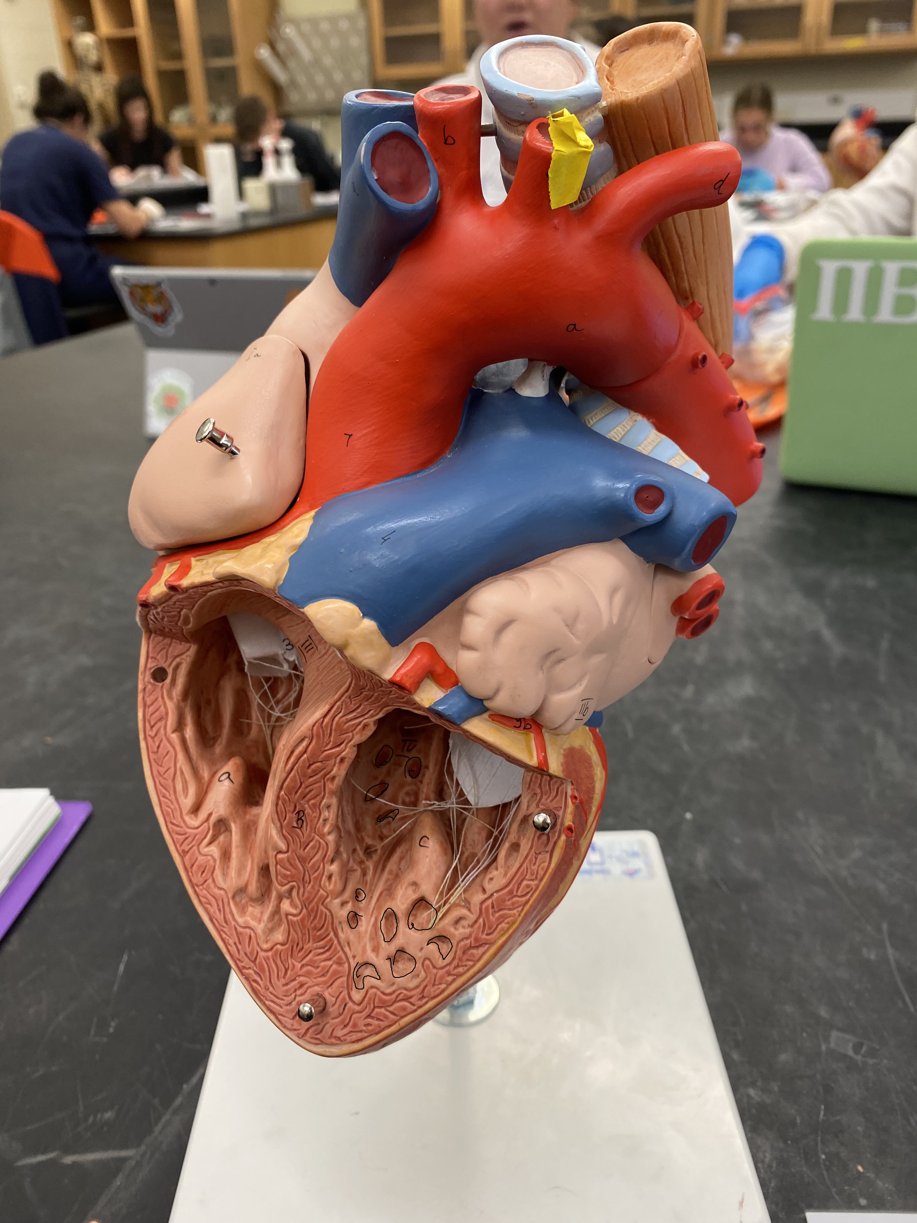 <p>what is outlined in black within the left ventricle?</p>