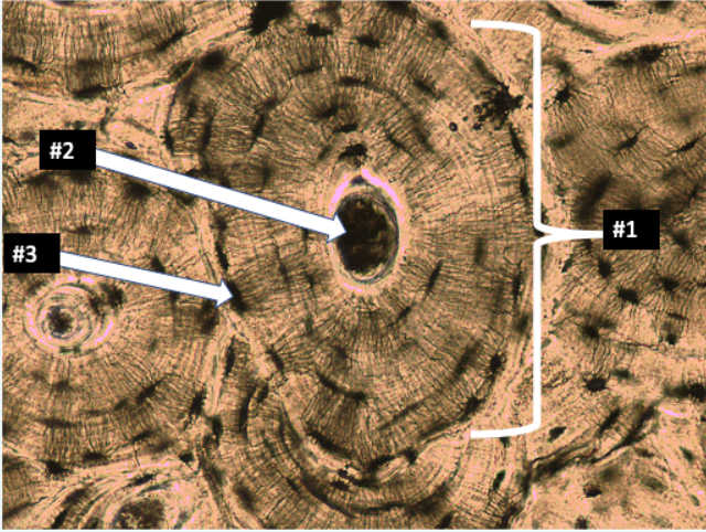 <p><span style="font-family: Arial; color: rgb(0, 0, 0)">What type of tissue is this?</span><br><span style="font-family: Arial; color: rgb(0, 0, 0)">What is the function?</span><br><span style="font-family: Arial; color: rgb(0, 0, 0)">Where can it be found?</span><br><span style="font-family: Arial; color: rgb(0, 0, 0)">Identify Haversian Canal, Osteocytes, Lucuna, Osteon</span></p><p></p>