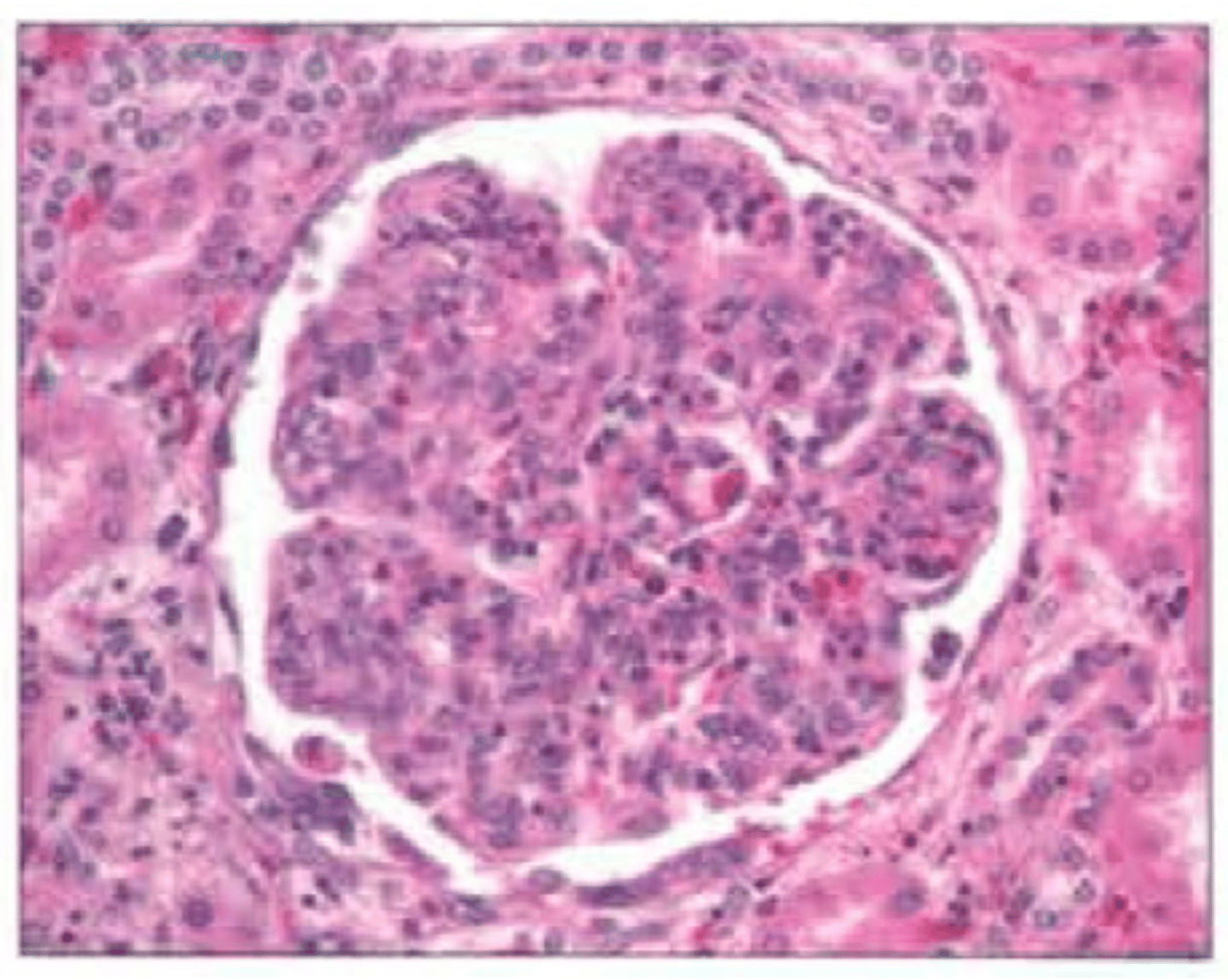 <ul><li><p>Glomerulus (network of capillaries inside the Bowman's capsule)</p></li><li><p>Bowman's capsule (the white outline)</p></li><li><p>Things surrounding the Bowman's capsule could be the proximal convoluted tubule and/or distal convoluted tubule</p></li></ul><p></p>