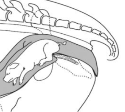 <p>When the foetus is presented backward or tail first, which can impede normal delivery. But all malposition or malpresentation are considered breech. </p>