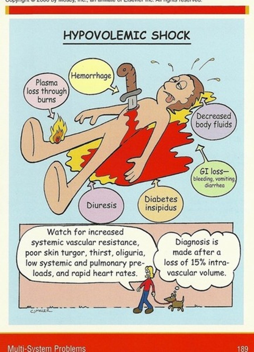<p>Loss of intravascular fluid volume. (Bleeding, 3rd spacing, vomiting, diarrhea)</p><p>Causes: bleeding, trauma, surgery, Vomiting, diarrhea, loss of lots of fluids</p><p>Assessment findings: tachycardia, hypotension, cool clammy skin, decreased Urinary output, confusion</p><p>Interventions: blood and fluid replacement, Normal Saline: 3 ml of isotonic solution for 1 ml of blood loss</p><p>- want to know why happened and don't want to give to much fluid</p>