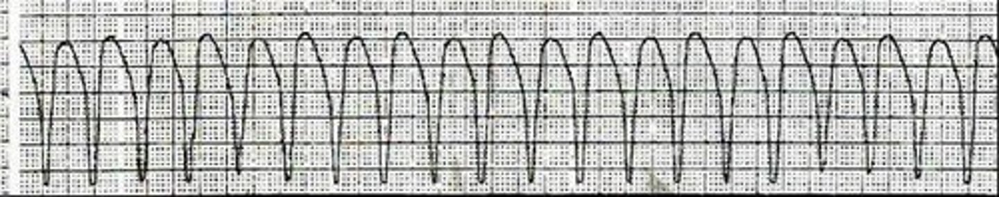 <p>Same Shapes V Tach</p>