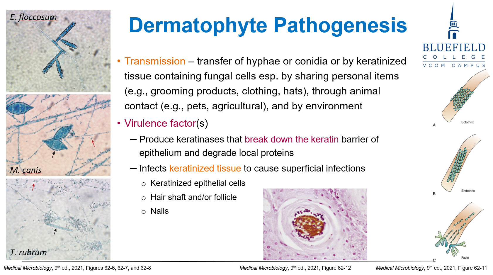<p>B. Human and animal contact with infected keratin<br></p><p>Dermatophytes infect <strong>keratinized tissues</strong> and spread via <strong>contact</strong> with infected <strong>skin, hair, or nails</strong>.</p>
