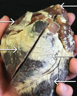 <p>upper right arrow </p>