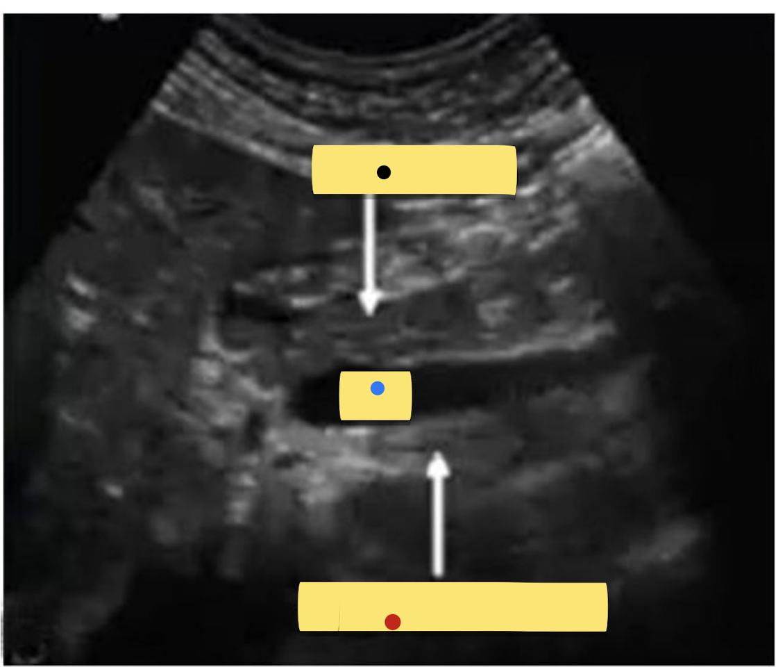 <p>Label&nbsp;the Sagittal Image</p><p>Black = ?</p><p>Blue = ?</p><p>Red = ?</p>