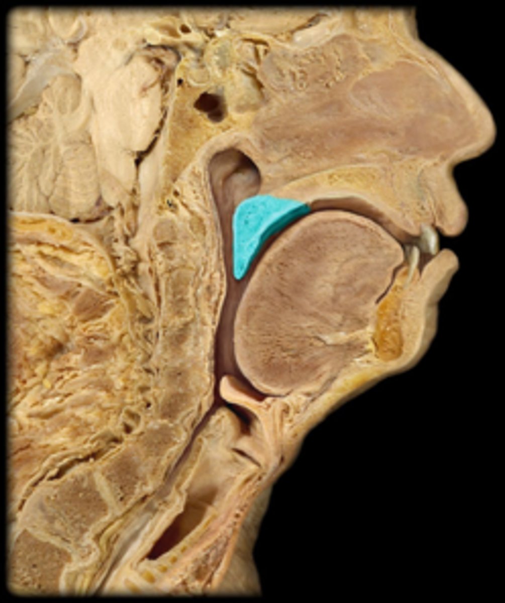 <p>Identify this specific structure.</p>