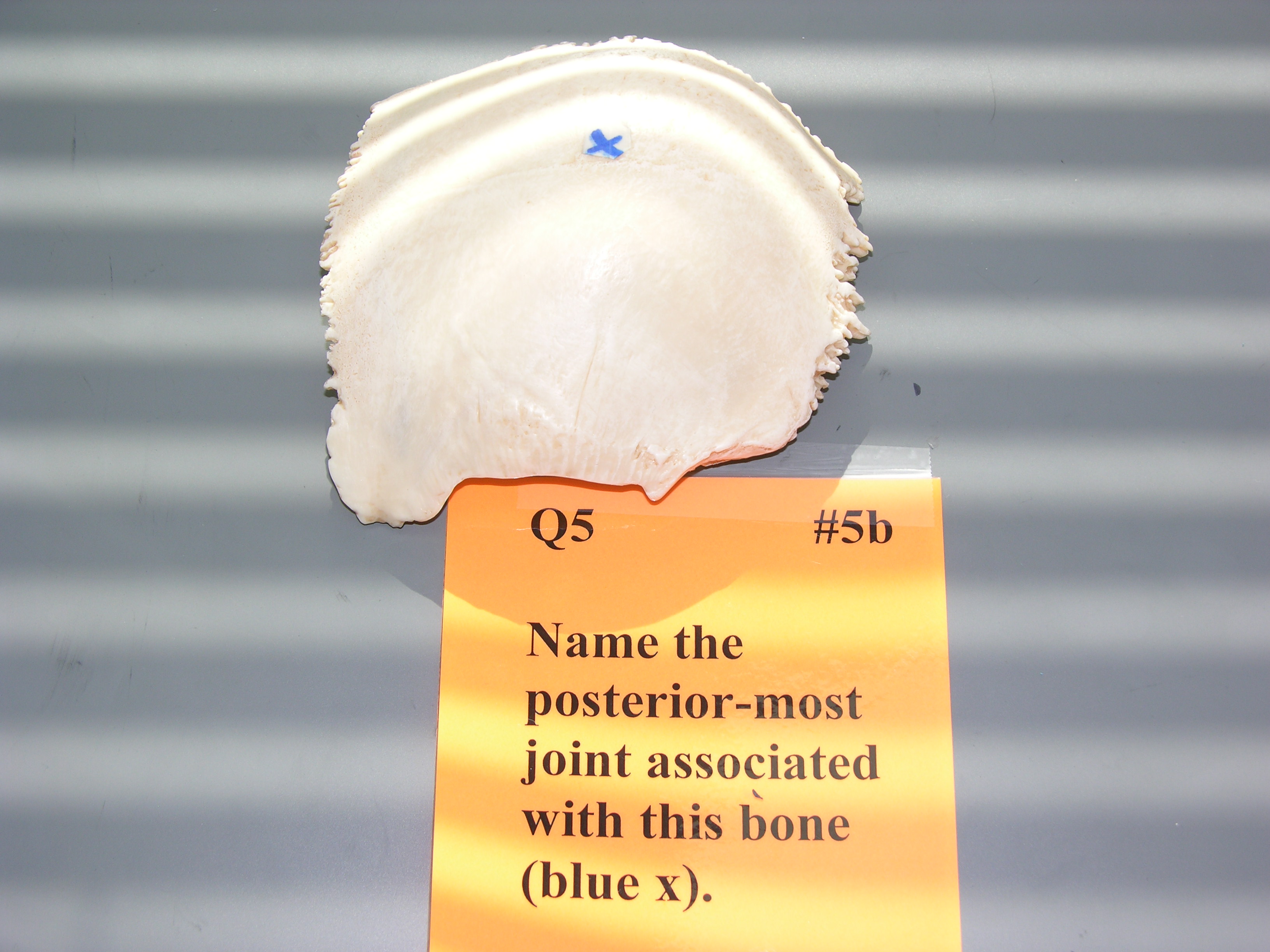 <p><span style="font-family: Lato Extended, Lato, Helvetica Neue, Helvetica, Arial, sans-serif; color: rgb(45, 59, 69)">Name the posterior-most joint associated with this bone.</span></p>