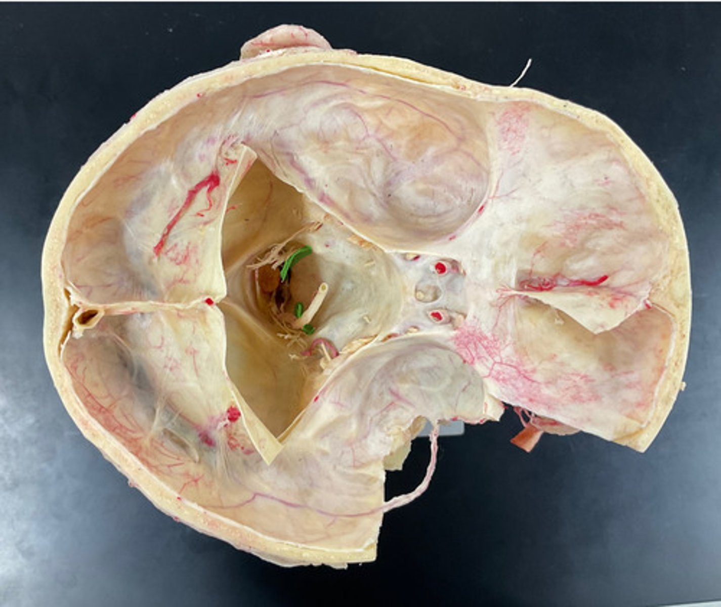 knowt flashcard image