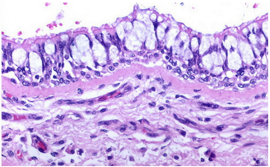 <ul><li><p>The architecture of the nasal cavity and sinuses is designed with a <strong>large surface area </strong>to warm and moisten inhaled air.</p></li><li><p>The cavities are lined with<strong> pseudostratified columnar epithelium.</strong></p></li><li><p>The columnar cells have numerous <strong>cilia </strong>on their surface.</p></li><li><p>The epithelium also contains mucous secreting <strong>goblet cells</strong>.</p></li><li><p>This type of epithelium (pseudostratified columnar, with cilia and goblet cells) is present throughout the upper respiratory system and is known as <strong>respiratory type epithelium</strong>.</p></li><li><p>The walls of the trachea and large bronchi are supported by <strong>rings of hyaline cartilage</strong> and have incomplete smooth muscle support.</p></li><li><p>As the airways become smaller, cartilage rings are replaced with cartilage plates (in the intrapulmonary bronchi) and eventually <strong>smooth muscle</strong> becomes the major component of support.</p></li></ul>