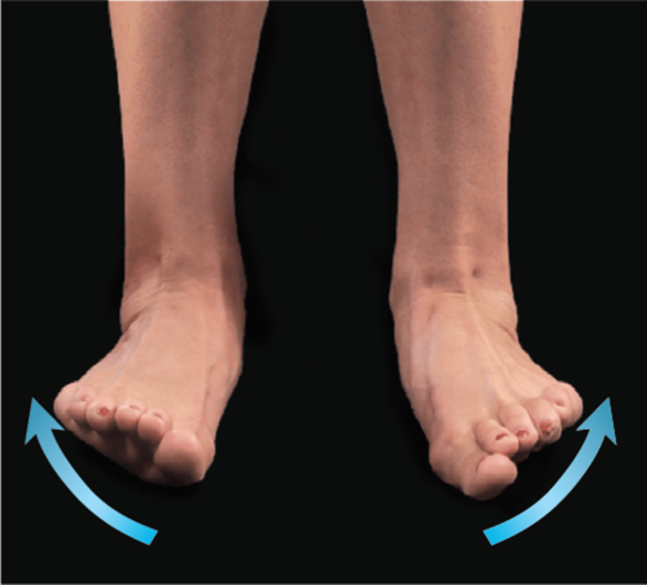 <p>soles face laterally</p>