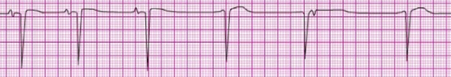 <p>Start high-quality CPR</p>