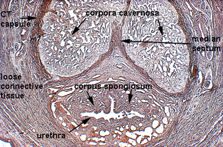 <p><strong>Penis</strong></p><ul><li><p class=""><strong>Two corpora cavernosa</strong> (top) and <strong>one corpus spongiosum</strong> (bottom)</p></li><li><p class="">Each erectile body is surrounded by <strong>tunica albuginea</strong> </p></li><li><p class=""><strong>Urethra</strong> runs through the <strong>corpus spongiosum</strong>, lined by <strong>transitional or pseudostratified epithelium</strong></p></li></ul><p></p>