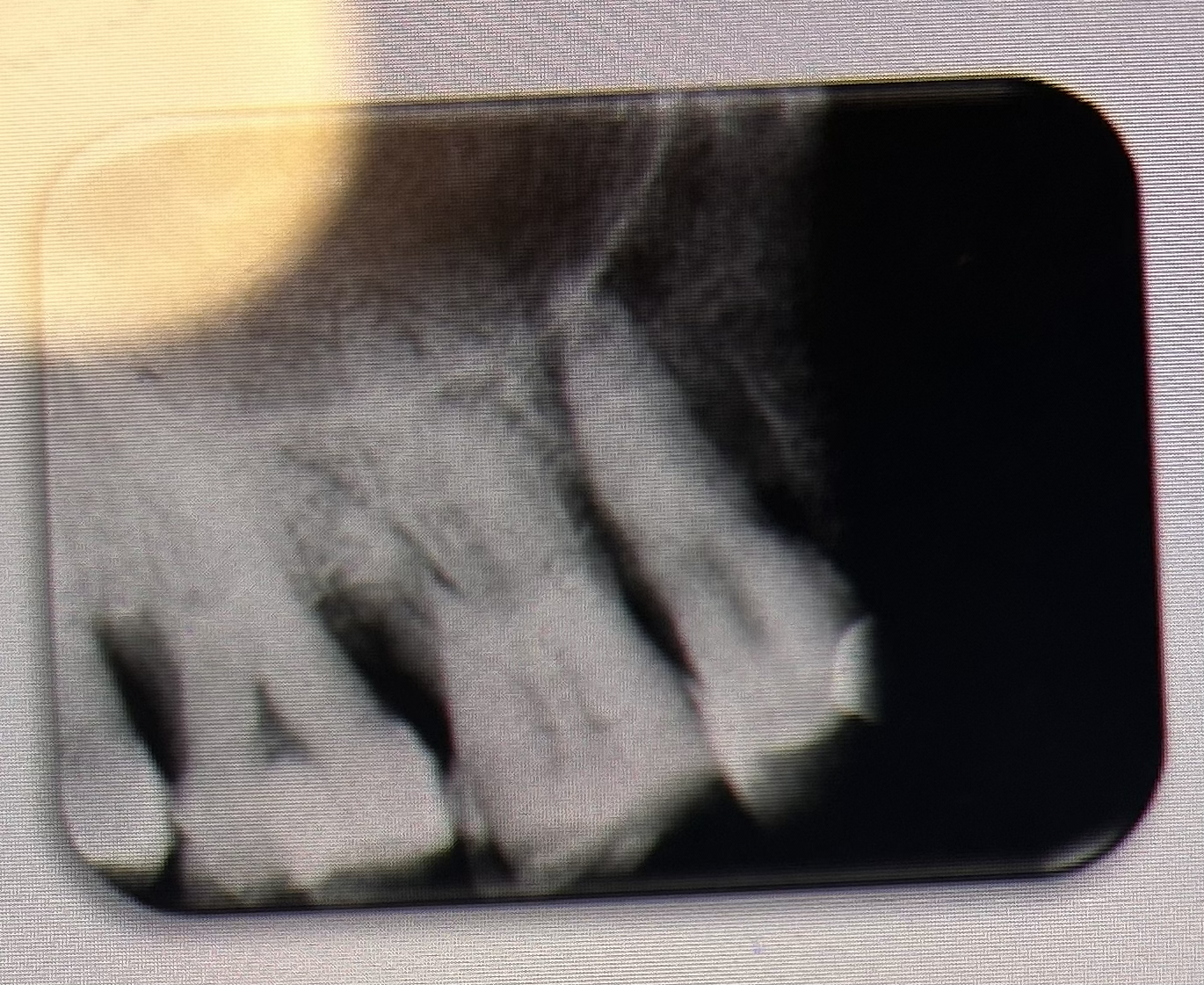 <p>THE PROCESSING ERROR DEPICTED IN THE PICTURE CAN BE DESCRIBED AS WHAT? THE CAUSE WAS DUE TO:</p>