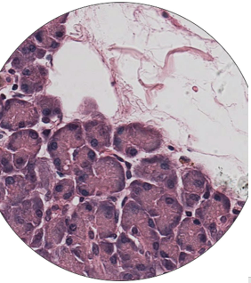 <p>label cells</p>