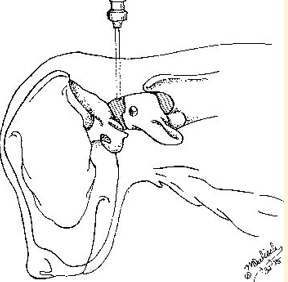 <p>Site for cisternal puncture </p>