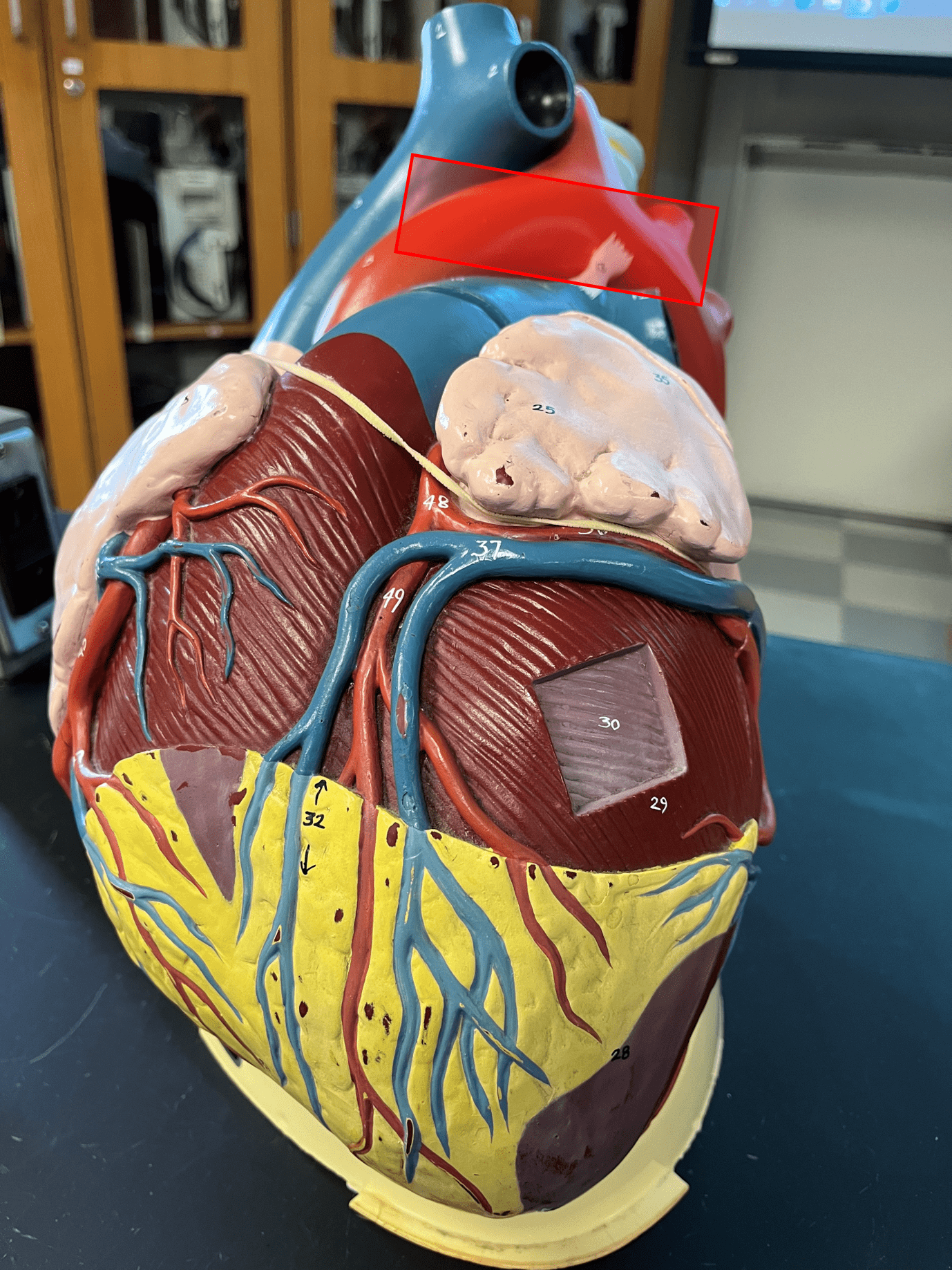 • The part of the aorta that inverts downwards.

• Continues on as the descending aorta.