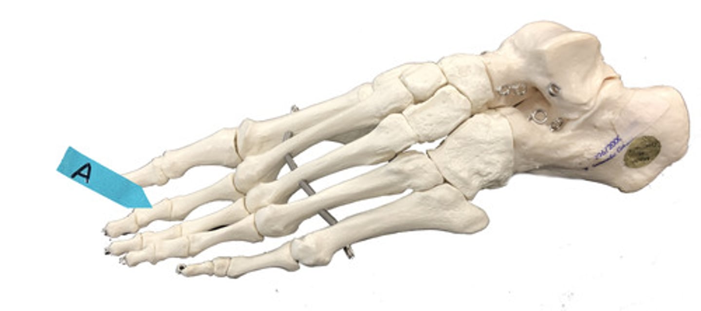 <p>Identify the bone (be specific).</p>