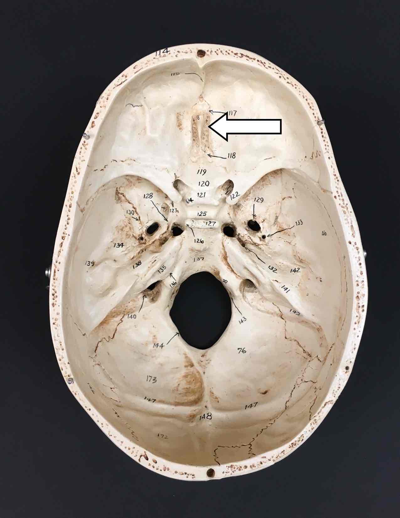 <p>Name the cranial nerve that passes through this hole and its roman numeral</p>