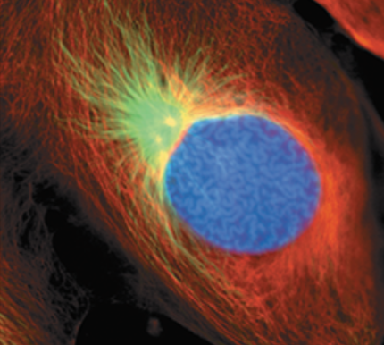 <p>What stage of mitosis is shown here?</p>