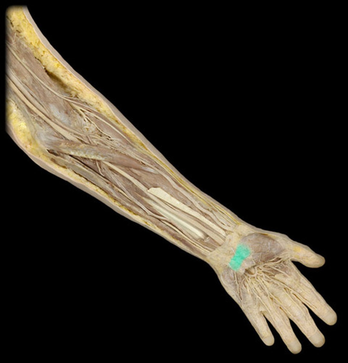 <p>connects the tubercles of scaphoid and trapezium and pisiform and the hook of the hamate; forms the roof of the carpal tunnel</p>