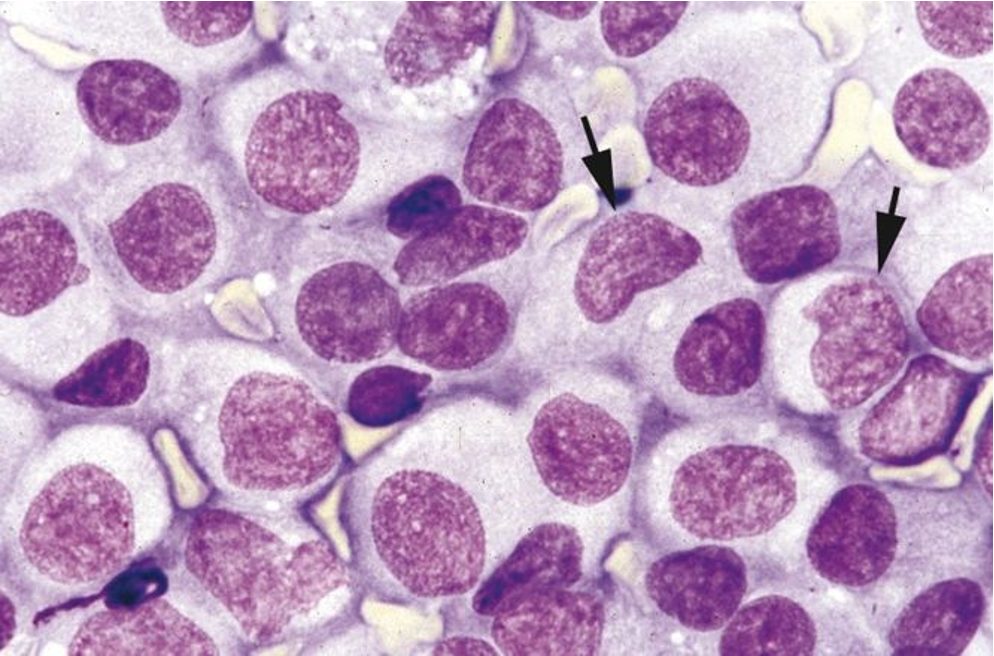 <p>Cutaneous histocytoma is often called a “button lesion.”</p>