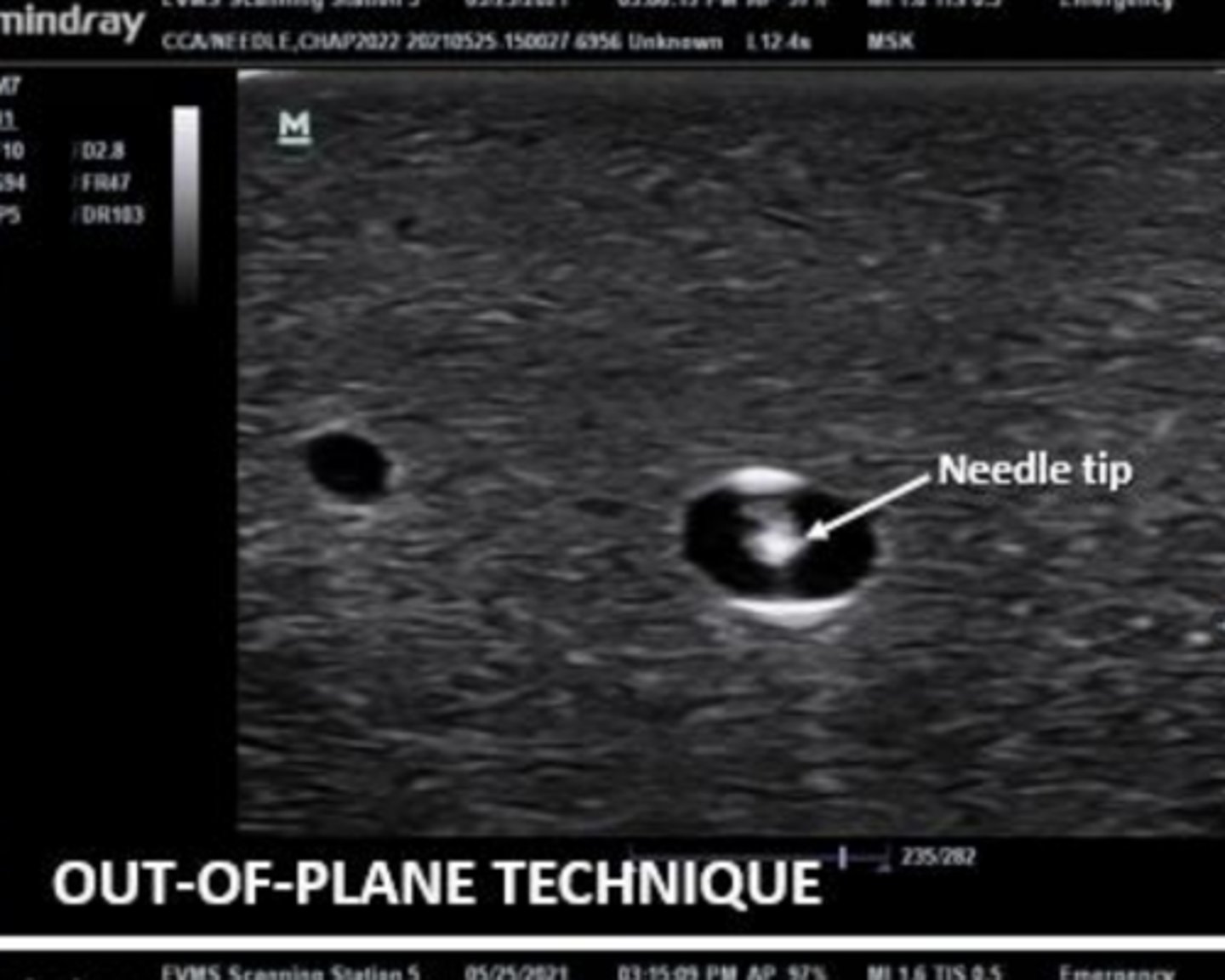 knowt flashcard image