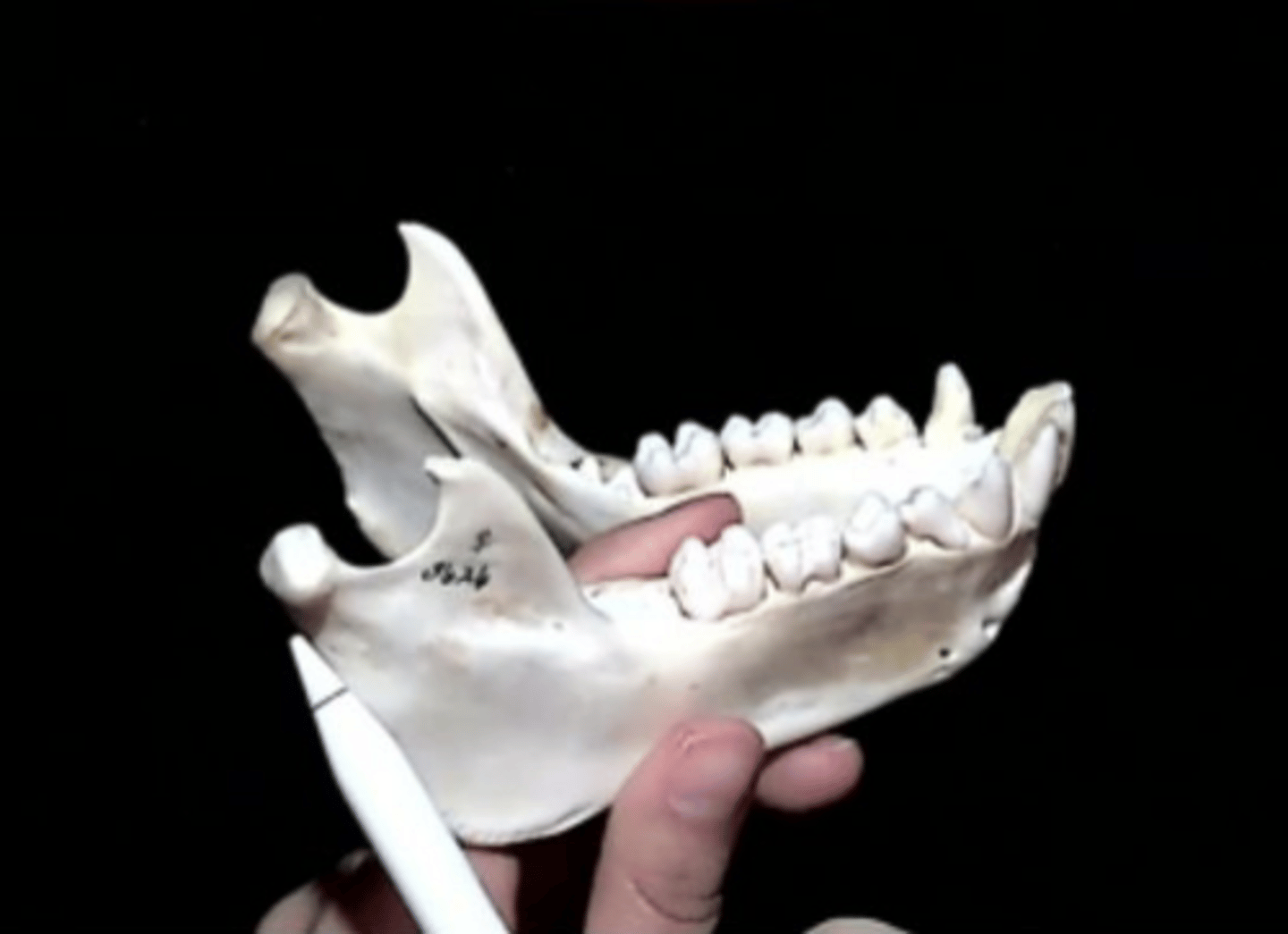 <p>Articulation point of the mandible with the mandibular fossa of the temporal bone</p>