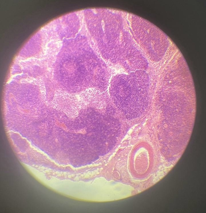 <p>Лімфатичний вузол </p>