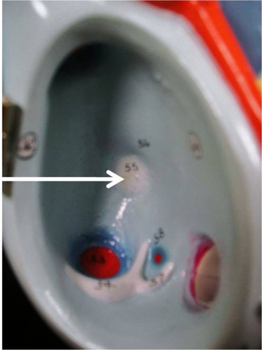 <p>Identify</p>