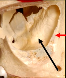 <p>there are small ridges and bumps- thin in cross sections - can appear as <strong>dense white opaque lines radiographically </strong></p>
