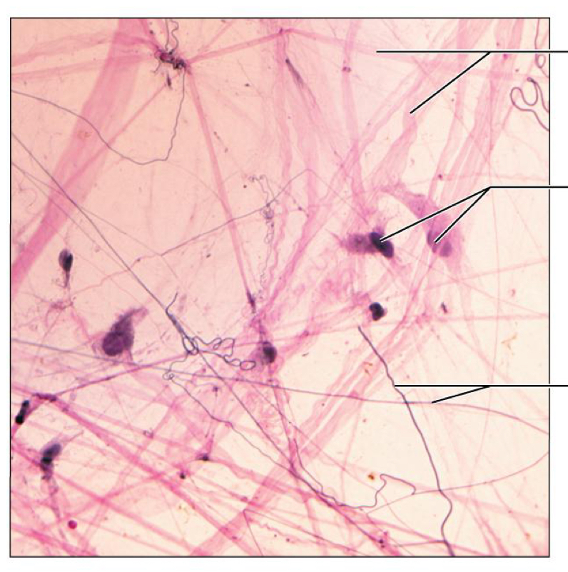 <p>What tissue is this</p>