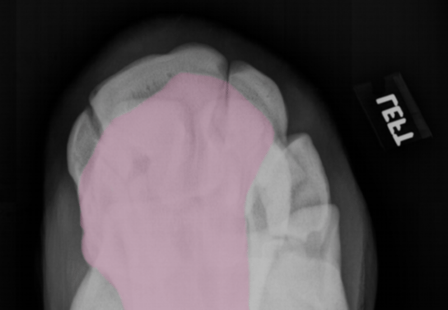 <p>What bone is highlighted?</p>