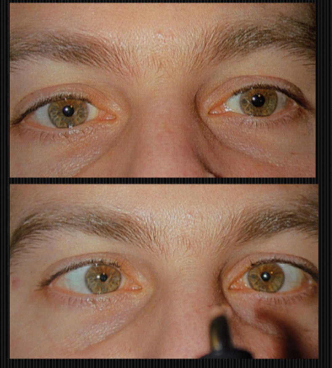 <p>slow, tonic constriction to near</p>
