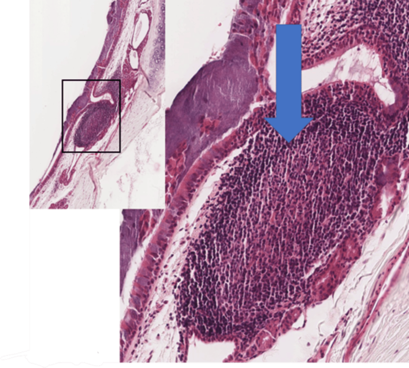 <p>Identify the structure in the trachea</p>