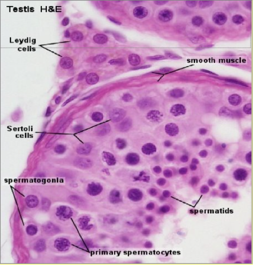 <p>Secondary spermatocytes are not seen easily as they progress quickly to spermatids</p><p>Adjacent to the lumen, spermatozoa can be seen</p><ul><li><p>Between strands of developing spermatids are → <u>Sertoli cells</u> (columnar large oval nucleus and dense nucleolus)</p><ul><li><p>secrete fluid which i) <mark data-color="yellow" style="background-color: yellow; color: inherit">nourishes the developing sperm</mark> and ii) <mark data-color="yellow" style="background-color: yellow; color: inherit">protects them from immune system</mark></p></li></ul></li><li><p>Cells between seminiferous tubules called → <u>Leydig cells</u> which secrete <mark data-color="yellow" style="background-color: yellow; color: inherit">testosterone</mark></p><ul><li><p><mark data-color="yellow" style="background-color: yellow; color: inherit">essential in sperm formation and maturation</mark> aswell as development of male secondary sexual characteristics</p></li></ul></li></ul><p></p><p></p><p></p>