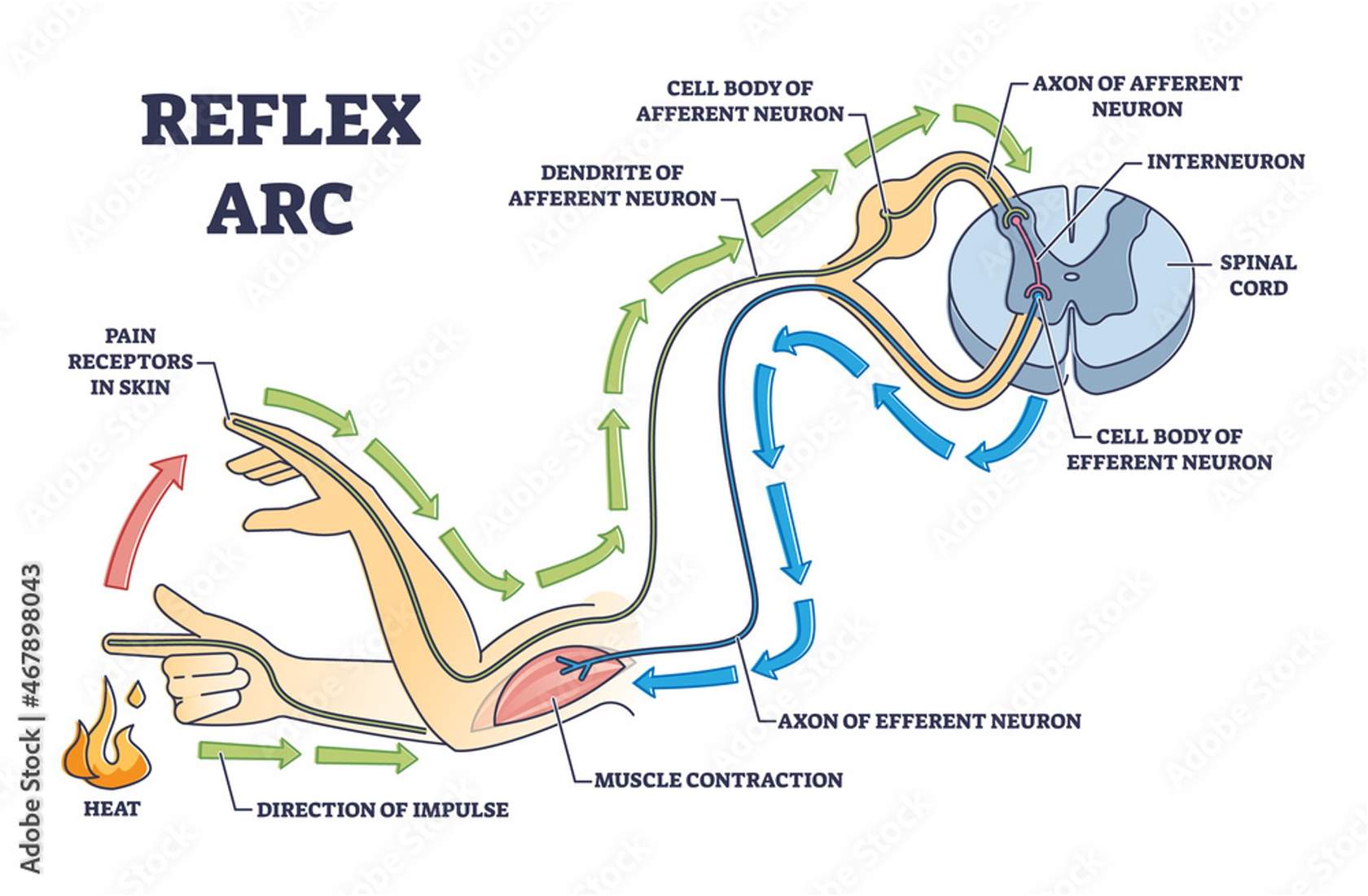 <p>example of reflex arc situation</p>